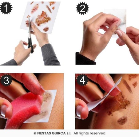 Tatuajes Con Heridas Infectadas