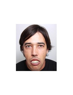 DIENTES BRAKETS 2