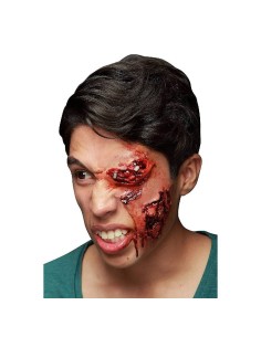 CICATRIZ INFECTADO LATEX