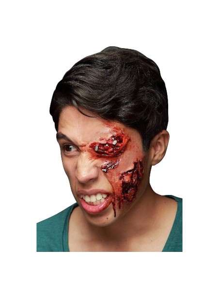 CICATRIZ INFECTADO LATEX