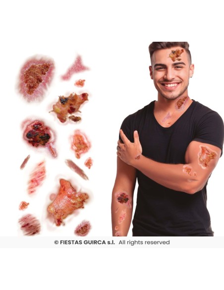 Tatuaje heridas con   infectadas 30x13 c