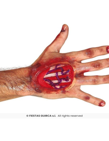 Cicatriz tendones mano 10 cms, latex