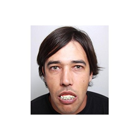 DIENTES BRAKETS
