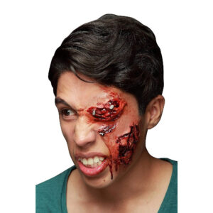 CICATRIZ INFECTADO LATEX