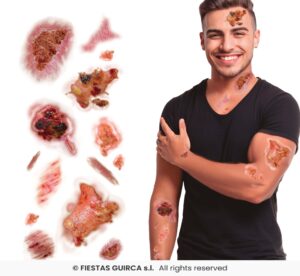 Tatuajes Con Heridas Infectadas