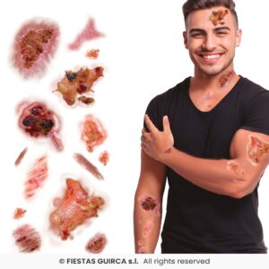 Tatuajes Con Heridas Infectadas