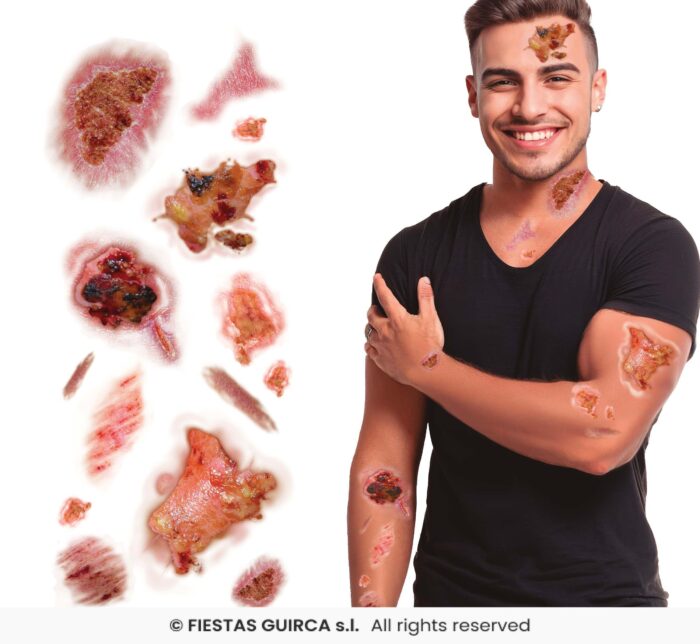 Tatuajes Con Heridas Infectadas - Imagen 1