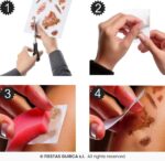 Tatuajes Con Heridas Infectadas - Imagen 3
