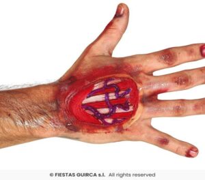 Cicatriz tendones mano 10 cms, latex