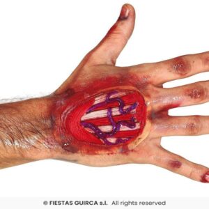 Cicatriz tendones mano 10 cms, latex